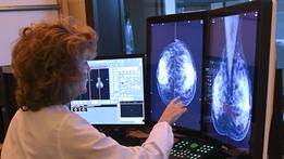 Ulss 8 Berica Vicenza hospital and Montecchio take the lead in diagnosing and fighting breast cancer