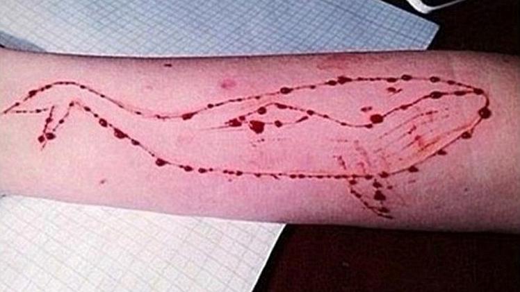 La balena incisa sul braccio