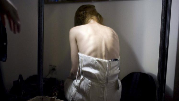 Sono centinaia le ragazze che soffrono di anoressia seguite dal Centro di riferimento provinciale