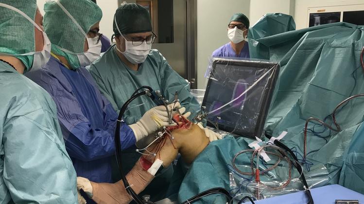 Un’operazione al ginocchio utilizzando il robot per la chirurgia ortopedica Navio