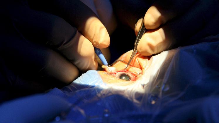 Un intervento chirurgico ad un occhio. (Foto Archivio)